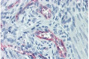 Human Uterus, Vessels: Formalin-Fixed, Paraffin-Embedded (FFPE)