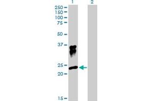 Western Blot analysis of ORM1 expression in transfected 293T cell line by ORM1 MaxPab polyclonal antibody. (ORM1 Antikörper  (AA 1-201))