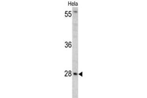 Western blot analysis of HPRT1 antibody (C-term) in Hela cell line lysates (35ug/lane). (HPRT1 Antikörper  (C-Term))