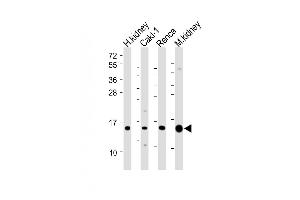 All lanes : Anti-ATP6V1G3 Antibody (N-Term) at 1:2000 dilution Lane 1: Human kidney lysate Lane 2: Caki-1 whole cell lysate Lane 3: Renca whole cell lysate Lane 4: Mouse kidney lysate Lysates/proteins at 20 μg per lane. (ATP6V1G3i Antikörper  (AA 15-49))