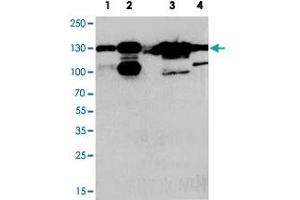 Western blot analysis of whole cell extracts with THBS2 polyclonal antibody . (Thrombospondin 2 Antikörper  (Middle Region))