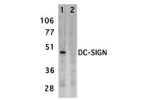 Western Blotting (WB) image for anti-CD209 (CD209) (Extracellular Domain) antibody (ABIN1030833) (DC-SIGN/CD209 Antikörper  (Extracellular Domain))