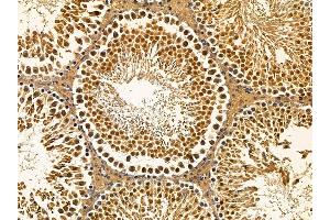 ABIN7095759 and ABIN7099821 at 1/100 staining rat testis tissue by IHC-P.