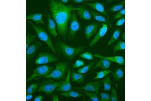 IF analysis of OAS3 using anti-OAS3 antibody (ABIN7602725).