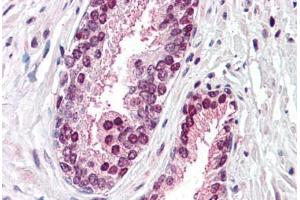Anti-CDCP1 antibody  ABIN960755 IHC staining of human prostate. (CDCP1 Antikörper  (Internal Region))