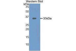 Detection of Recombinant LOX1, Rat using Polyclonal Antibody to Lectin Like Oxidized Low Density Lipoprotein Receptor 1 (LOX1) (OLR1 Antikörper  (AA 51-314))