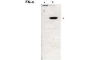Image no. 1 for anti-Signal Transducer and Activator of Transcription 2, 113kDa (STAT2) (pTyr690) antibody (ABIN291118) (STAT2 Antikörper  (pTyr690))