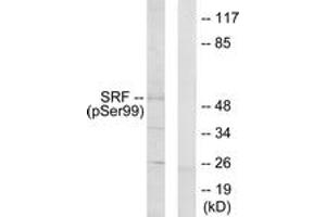 Western blot analysis of extracts from LOVO cells treated with Serum 10% 15', using SRF (Phospho-Ser99) Antibody. (SRF Antikörper  (pSer103))