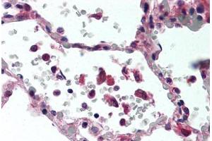 Human Lung (formalin-fixed, paraffin-embedded) stained with TNF antibody ABIN305730 at 2. (TNF alpha Antikörper)