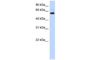 CDYL antibody used at 1 ug/ml to detect target protein. (CDYL Antikörper  (N-Term))
