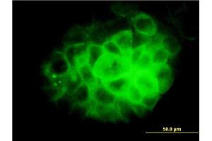 Immunofluorescence of monoclonal antibody to DNAI2 on A-431 cell. (DNAI2 Antikörper  (AA 1-593))