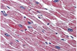 Human Heart: Formalin-Fixed, Paraffin-Embedded (FFPE) (DLD Antikörper  (AA 1-510))