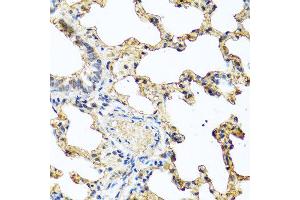 Immunohistochemistry of paraffin-embedded rat lung using PIP antibody at dilution of 1:100 (40x lens). (PIP Antikörper)