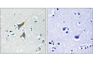 Immunohistochemistry analysis of paraffin-embedded human brain tissue, using MKP1 (Ab-359) Antibody. (DUSP1 Antikörper  (AA 318-367))
