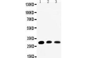 Anti-Aquaporin 1 antibody, Western blotting Lane 1: Rat Kidney Tissue Lysate Lane 2: Rat Lung Tissue Lysate Lane 3: SMMC Cell Lysate