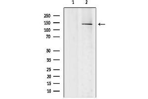 anti-SH3 Domain and Tetratricopeptide Repeats 2 (SH3TC2) (C-Term) antibody