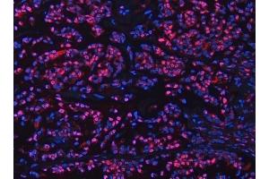 IF analysis of UBC12/UBE2M using anti-UBC12/UBE2M antibody (ABIN7600885). (UBE2M Antikörper  (AA 25-154))