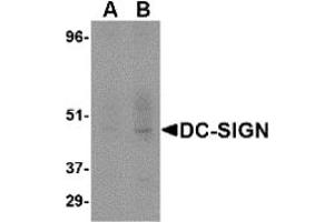 Western Blotting (WB) image for anti-CD209 (CD209) (Extracellular Domain) antibody (ABIN492510) (DC-SIGN/CD209 Antikörper  (Extracellular Domain))