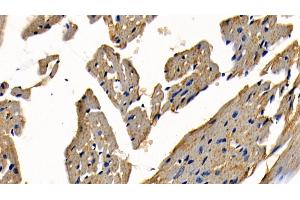 Immunohistochemistry (IHC) image for anti-TNF Receptor-Associated Factor 6 (TRAF6) (AA 153-423) antibody (ABIN7436348)