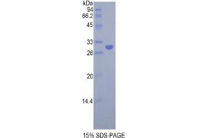 SDS-PAGE analysis of Rat LRPAP1 Protein. (LRPAP1 Protein)