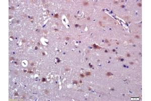 Formalin-fixed and paraffin embedded rat brain labeled with Anti-ABAT Polyclonal Antibody, Unconjugated (ABIN705641) at 1:200 followed by conjugation to the secondary antibody and DAB staining (ABAT Antikörper  (AA 151-250))