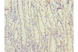 Immunohistochemistry of paraffin-embedded human small intestine tissue using ABIN7172730 at dilution of 1:100 (MTERFD3 Antikörper  (AA 1-250))