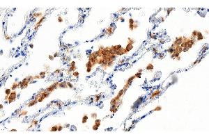 ABIN184738 (5µg/ml) staining of paraffin embedded Human Lung. (Iba1 Antikörper  (C-Term))