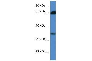 Western Blot showing MGC3207 antibody used at a concentration of 1. (MRI1 Antikörper  (N-Term))