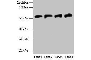 Western blot All lanes: FDXR antibody at 6 μg/mL Lane 1: A549 whole cell lysate Lane 2: Mouse liver tissue Lane 3: HepG2 whole cell lysate Lane 4: U251 whole cell lysate Secondary Goat polyclonal to rabbit IgG at 1/10000 dilution Predicted band size: 54, 55, 59, 49, 53, 50, 58 kDa Observed band size: 54 kDa (Ferredoxin Reductase Antikörper  (AA 33-451))