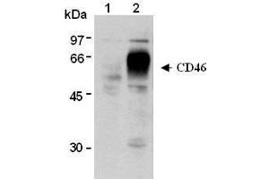 Western Blotting (WB) image for anti-CD46 (CD46) antibody (ABIN1449263) (CD46 Antikörper)