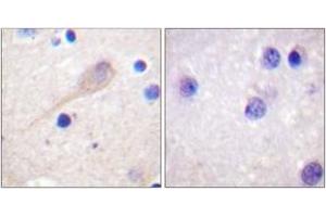 Immunohistochemistry analysis of paraffin-embedded human brain tissue, using Parkin (Ab-131) Antibody.