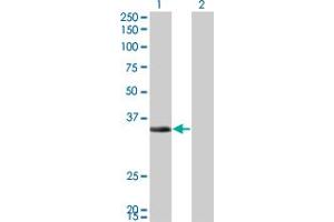 Western Blot analysis of ECH1 expression in transfected 293T cell line by ECH1 monoclonal antibody (M01), clone 5G8. (ECH1 Antikörper  (AA 21-120))