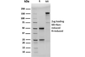 SDS-PAGE Analysis Purified CD23-Monospecific Mouse Monoclonal Antibody (FCER2/3592). (FCER2 Antikörper  (AA 48-321))