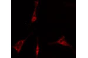 ABIN6275846 staining  293 cells by IF/ICC. (IRAK2 Antikörper  (Internal Region))