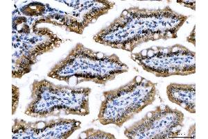 IHC analysis of CSNK2K2 using anti-CSNK2K2 antibody (ABIN7602871). (CSNK2A2 Antikörper  (C-Term))