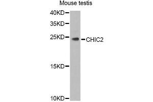 Western blot analysis of extracts of mouse testis, using CHIC2 Antibody (ABIN5974773) at 1/1000 dilution. (CHIC2 Antikörper)