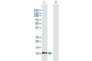 Western Blotting (WB) image for anti-Nephronophthisis 1 (Juvenile) (NPHP1) (AA 1-121) antibody (ABIN518422)