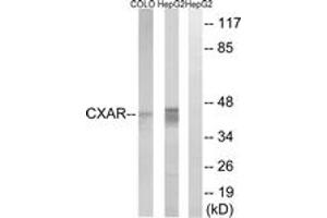 Western blot analysis of extracts from HepG2/COLO cells, using CXADR Antibody. (Coxsackie Adenovirus Receptor Antikörper  (AA 1-50))