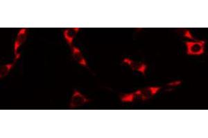 ABIN6274851 staining HuvEc by IF/ICC. (Anosmin Antikörper  (Internal Region))