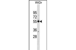 PSMD12 Antibody (Center) (ABIN1881697 and ABIN2838970) western blot analysis in WiDr cell line lysates (35 μg/lane).
