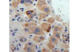 Used in DAB staining on fromalin fixed paraffin-embedded Liver tissue (Cathepsin S Antikörper  (AA 123-339))