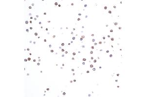 Immunocytochemistry (ICC) image for anti-HLA-DR-gamma (CD74) antibody (ABIN7449435) (CD74 Antikörper)