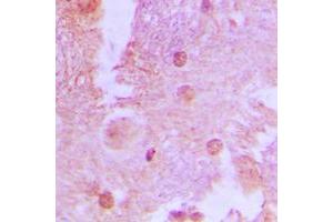 Immunohistochemical analysis of AS160 (pT642) staining in human brain formalin fixed paraffin embedded tissue section.