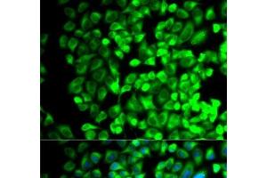 Immunofluorescence analysis of HeLa cells using TBXAS1 Polyclonal Antibody (TBXAS1 Antikörper)