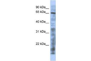 WB Suggested Anti-HTATIP Antibody Titration:  0.
