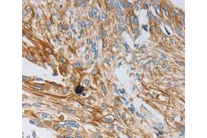 Immunohistochemistry (IHC) image for anti-Neurotrophin 3 (NTF3) antibody (ABIN3017532) (Neurotrophin 3 Antikörper)