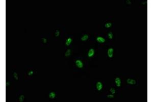 Immunofluorescence staining of Hela cells with ABIN7127716 at 1:100,counter-stained with DAPI. (Rekombinanter MYB Antikörper  (pSer11))
