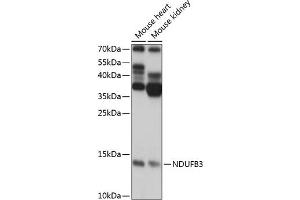 Western blot analysis of extracts of various cell lines, using NDUFB3 antibody (ABIN7268810) at 1:1000 dilution.