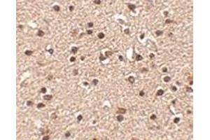 Immunohistochemistry (Paraffin-embedded Sections) (IHC (p)) image for anti-Dapper, Antagonist of beta-Catenin 2 (DACT2) (N-Term) antibody (ABIN499702)