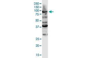 DCLK3 monoclonal antibody (M01), clone 2B1. (DCLK3 Antikörper  (AA 175-284))